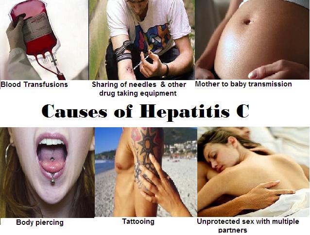 causes-of-hepatitis-c