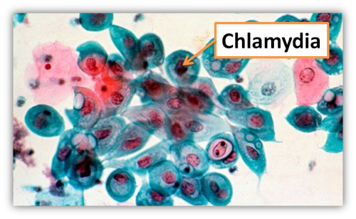 Chlamydia-Bacteria