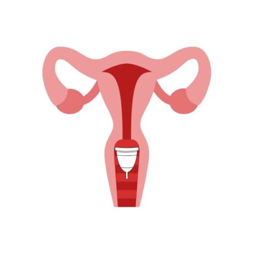 Da li je korišćenje menstrualnih čašica - revolucija?